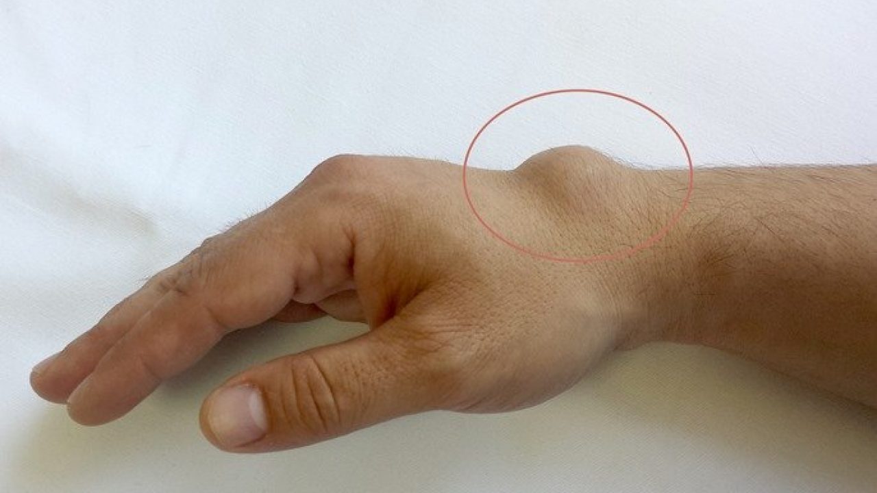 umflarea articulației mâinii și durere)