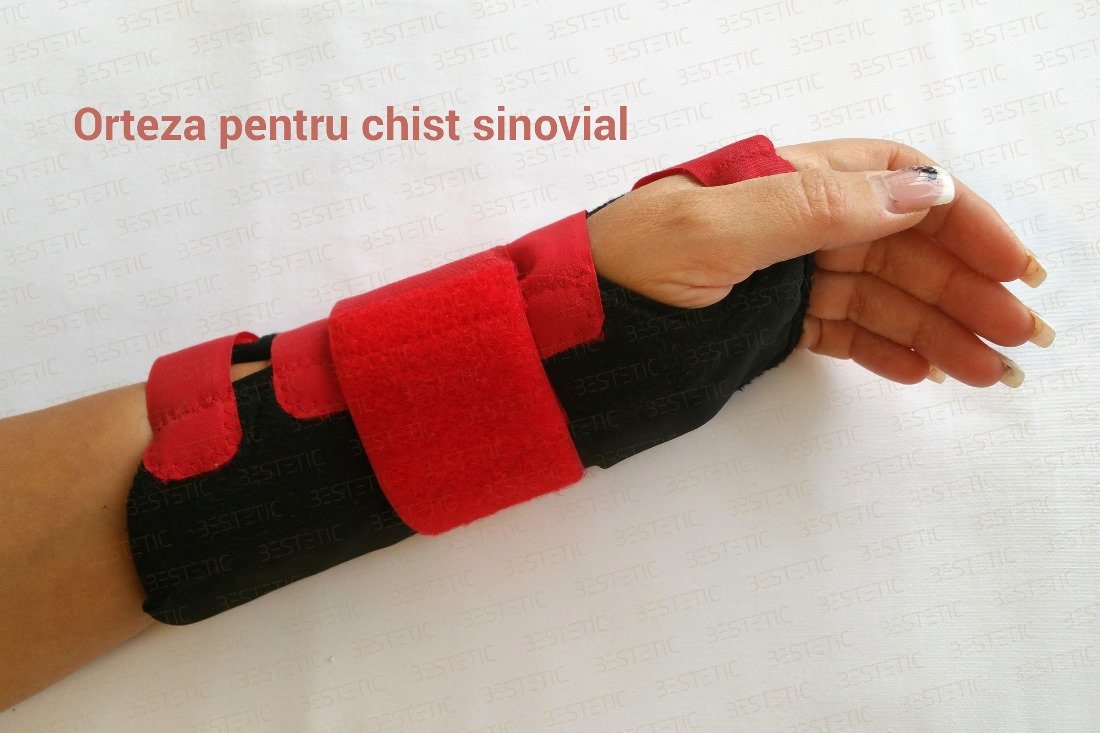tratamentul ganglionului la încheietura mâinii artroza articulației cotului