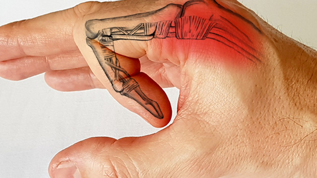 articulația degetului mic doare când este îndoită tratamentul capsulelor de umăr