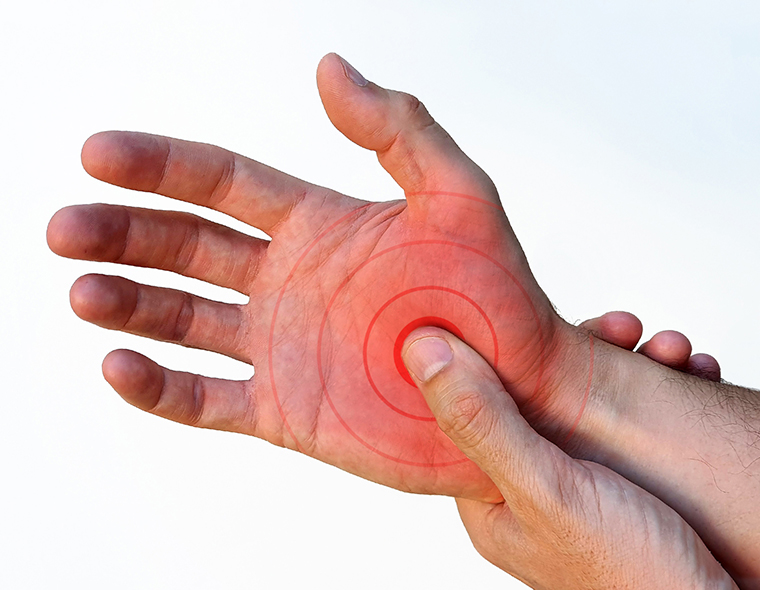leziune cronică la încheietura mâinii