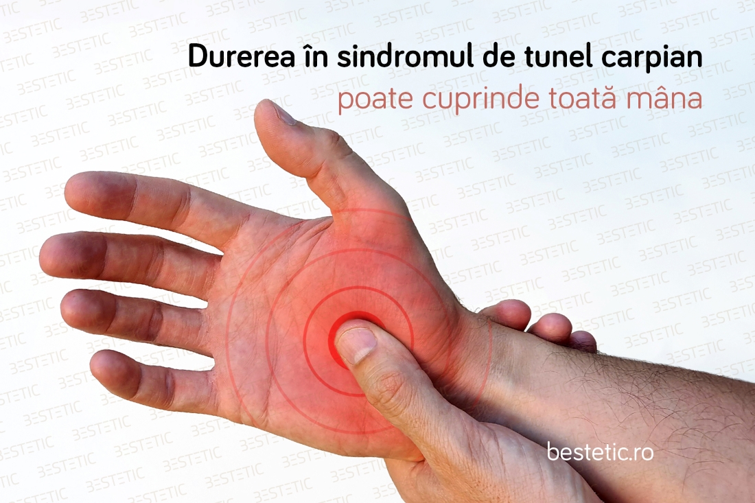 durere policlinică în articulațiile degetelor